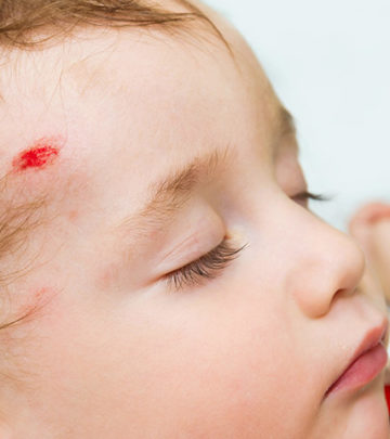 Head Injuries In Babies – Everything You Need To Know