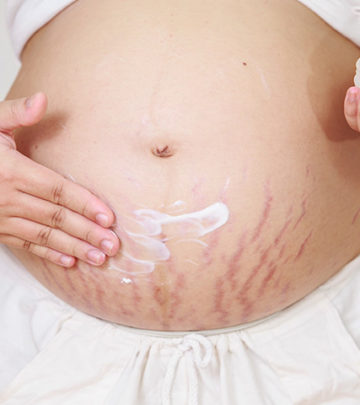 7 Home Remedies For Stretch Marks After Pregnancy