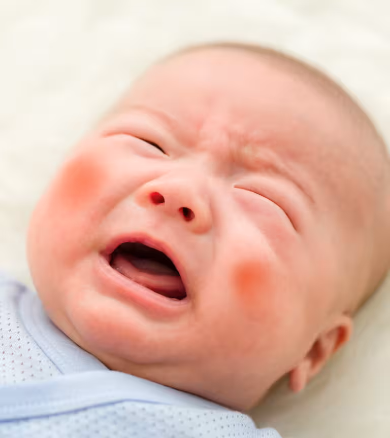 Bruises-In-Babies-Children1