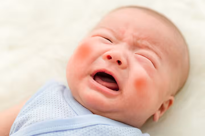 Bruises In Babies Bruises In Babies