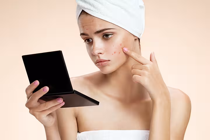 Teenage Skin Problems Skin Problems In Teens