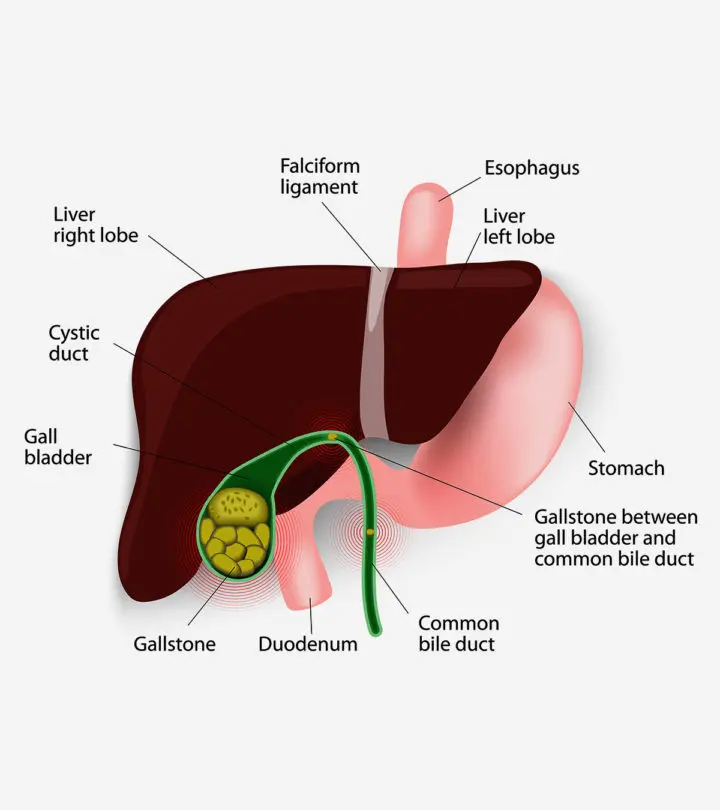 Gallstones-In-Children-–-Everything-You-Need-To-Know