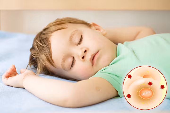 Warts In Toddlers Warts In Toddlers