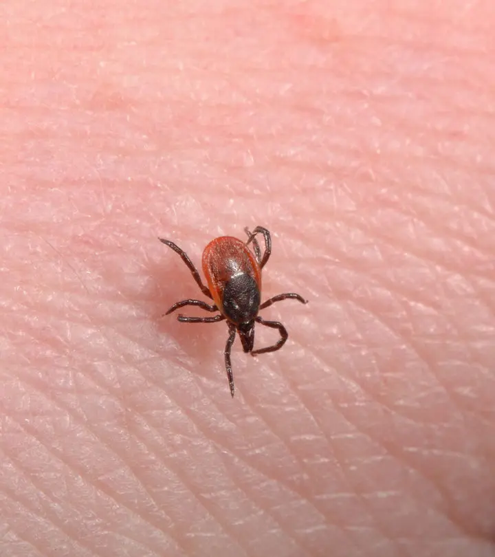 Lyme-Disease-In-Babies---Everything-You-Need-To-Know