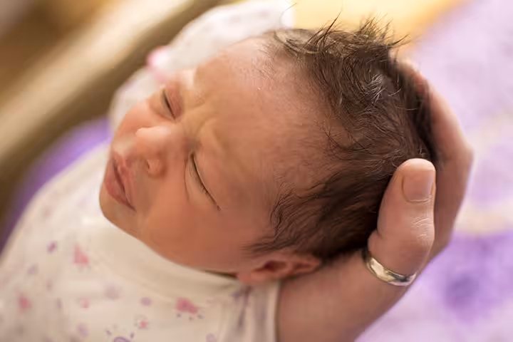 PKU In Babies Phenylketonuria (PKU) In Babies