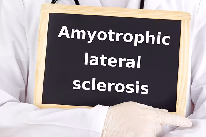 Als In Children Amyotrophic-Lateral-Sclerosis-In-Children