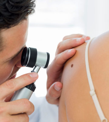 Skin Cancer In Teens – Everything You Need To Know‏