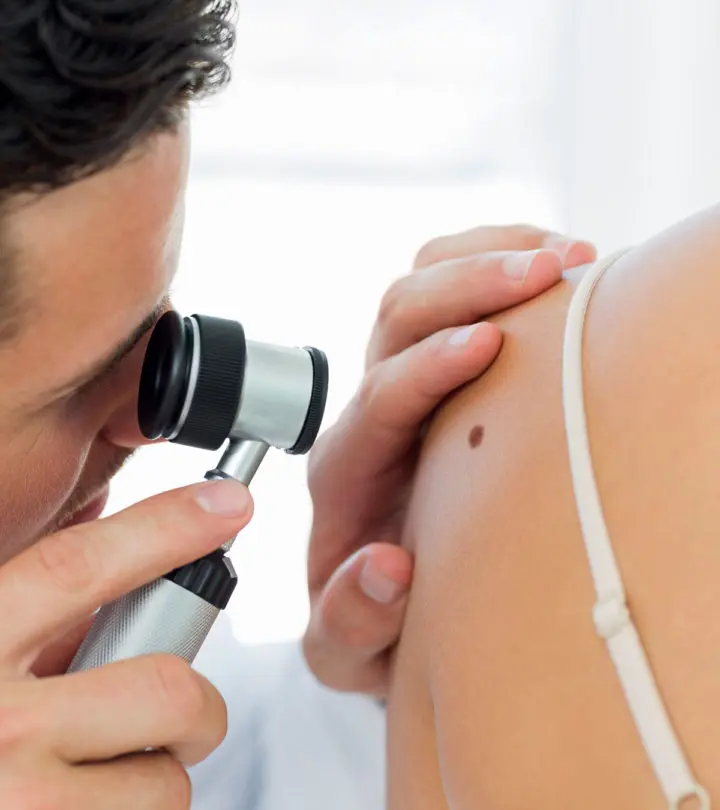 Skin Cancer In Teens – Everything You Need To Know‏_image