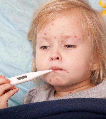 Chickenpox-In-Kids