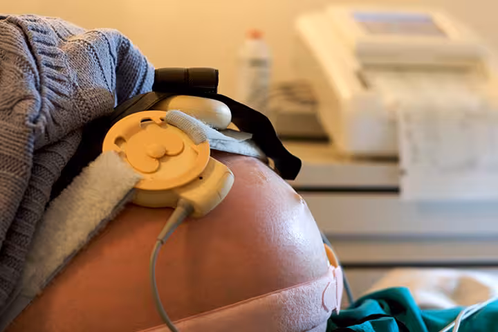 Contraction Stress Test