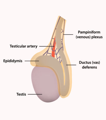 Pediatric Testicular Torsion - All You Need To Know