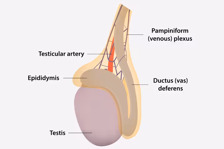Testicular Torsion In Children Testicular Torsion In Children