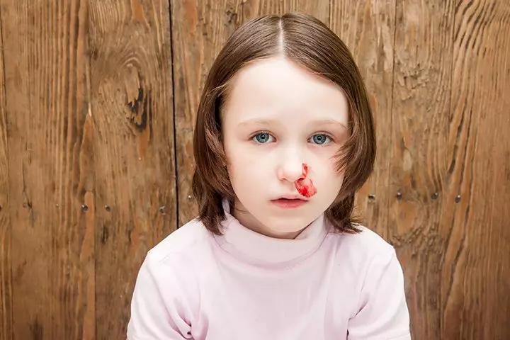 Von Willebrand Disease In Children – All You Need To Know_image