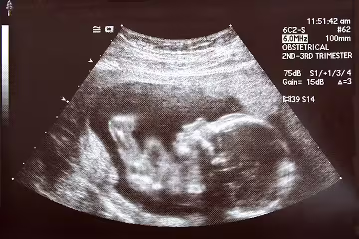The First Ultrasound Image The First Ultrasound Image