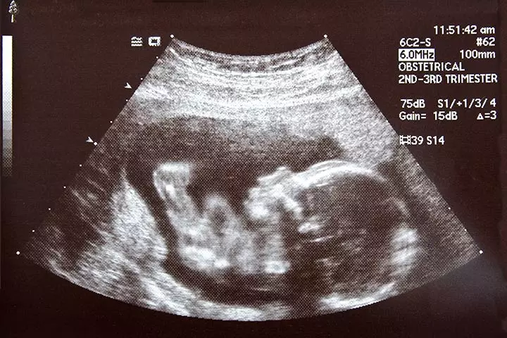 The First Ultrasound Image