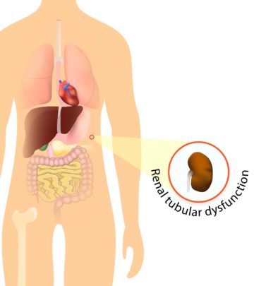 Renal Tubular Acidosis In Children - Symptoms & Treatment