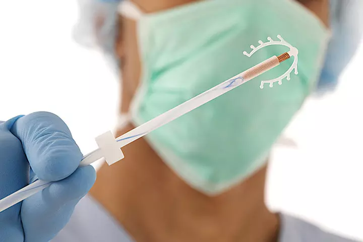 Intrauterine Device (IUD) For Birth Control – Advantages & Complications_image