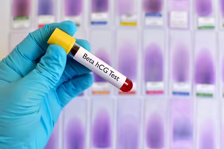 hCG Levels After Miscarriage hCG Levels After Miscarriage