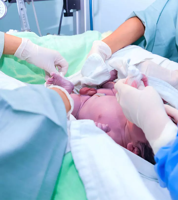 C-section Babies Healthier If Mothers Had Labor First