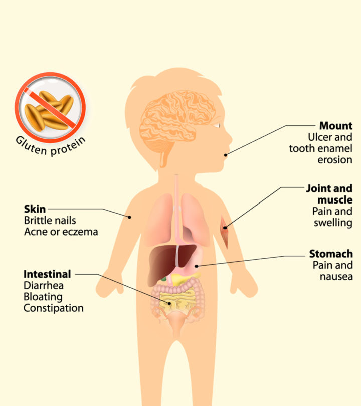 Celiac-Disease-In-Children