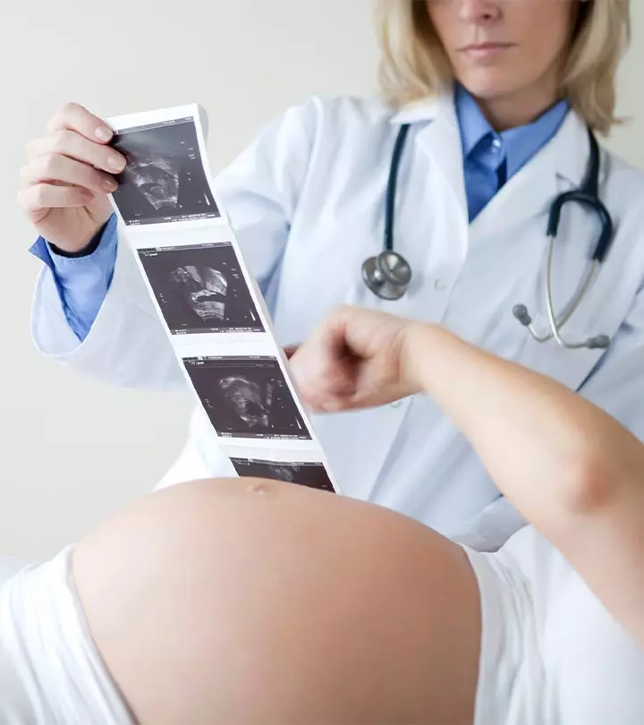 Here's-When-Your-Doctor-Can-Predict-Your-Baby's-Gender