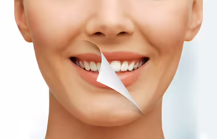 Whiten Your Teeth Whiten Your Teeth