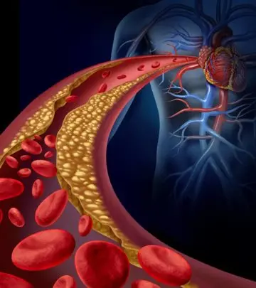 How To Clean Your Arteries Naturally_image