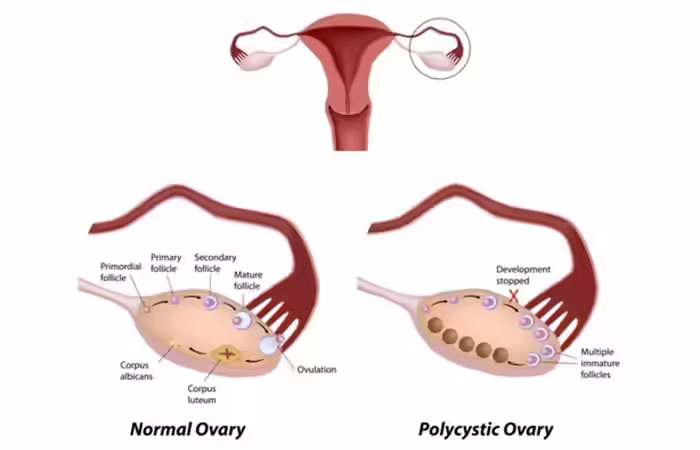 Every-Woman-Experiencing-Menstrual-Pain-Must-Know-This