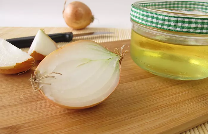 5. Onion Juice For Heat Stroke