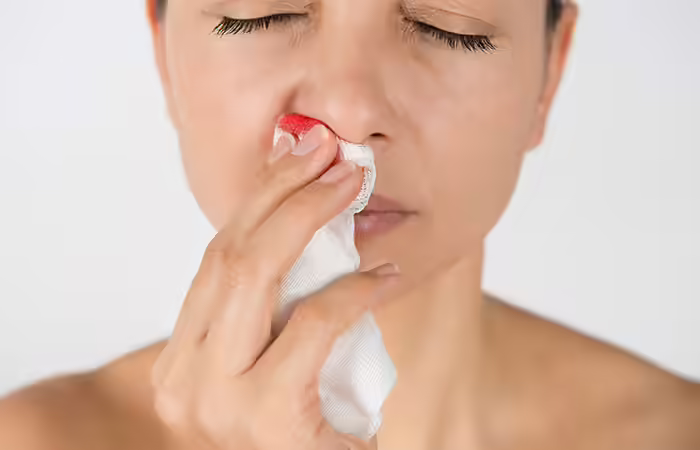 4. Throwing Back HeadLying On The Back During Nose Bleeds