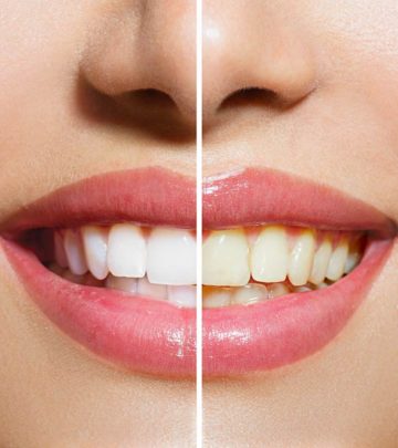 What Is The Best Way To Whiten Your Teeth?