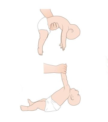 Floppy Baby Syndrome Causes, Symptoms And Treatments-1