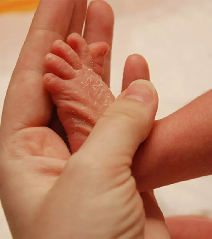 Treating Your Baby's Dry Skin A Paediatrician Explains