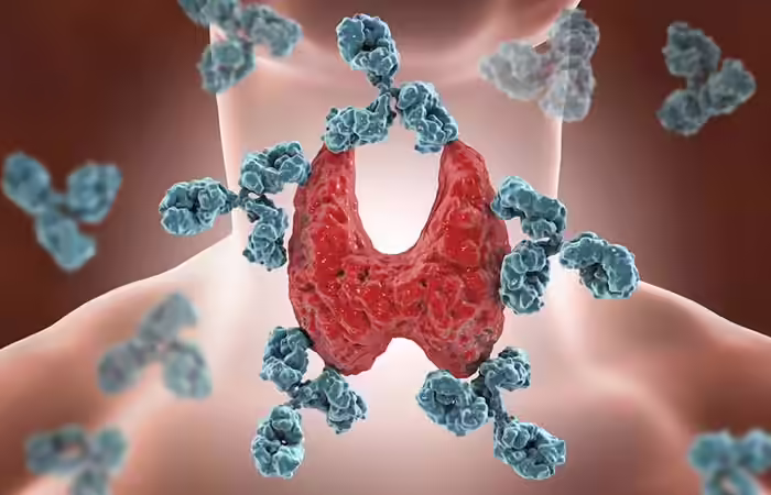 What Are The Causes Of An Underactive Thyroid Gland