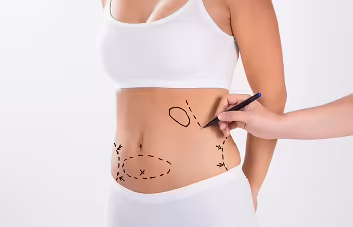 What Is Weight Loss Surgery And How Does It Work Weight Loss Surgery - What Is Weight Loss Surgery And How Does It Work