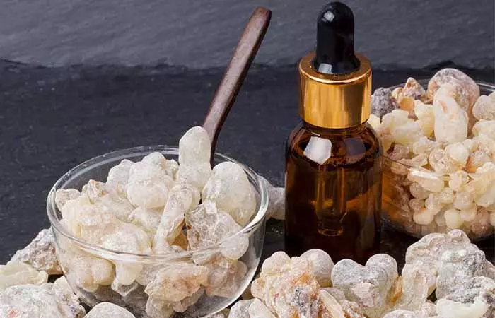 Lyme Disease - Frankincense Oil