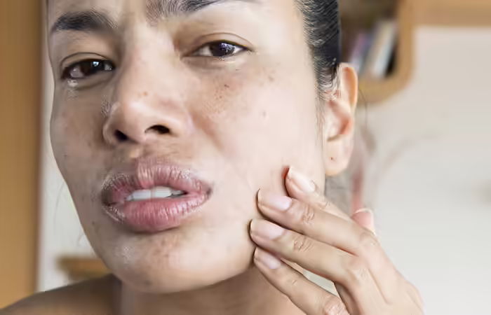 1. Your Skin Gets Dry And Flaky
