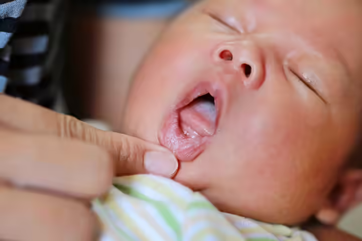 Fatal Herpes Simplex Virus Fatal Herpes Simplex Virus
