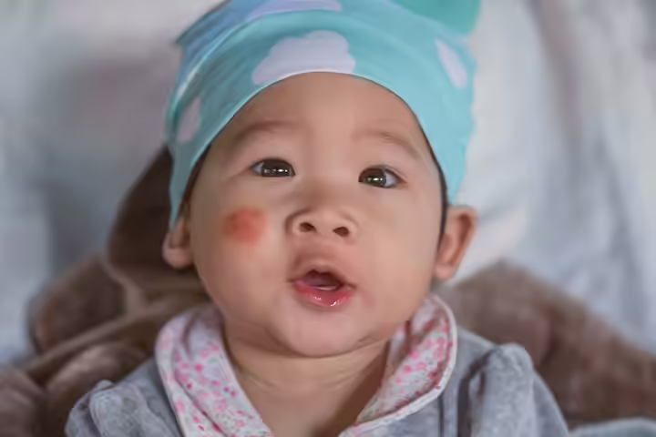 Hand, Foot and Mouth Disease Hand, Foot and Mouth Disease