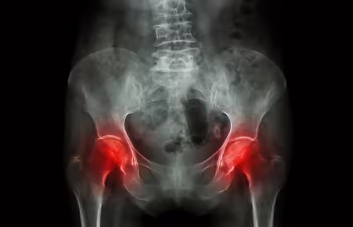Pelvic Pain