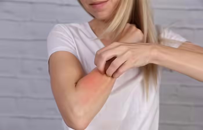 Dry, Itchy, And Flaky Skin