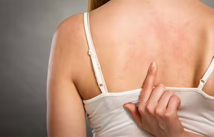 Worsens Disorders and Allergies