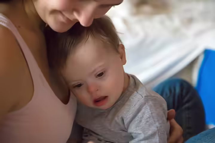 Defects During Birth Defects During Birth