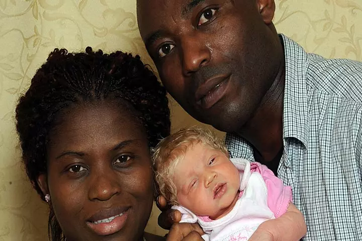 Black Nigerian Parents Have A White Baby