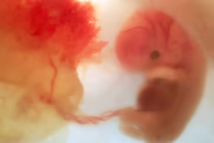 Month 2 Development (At 8 Weeks) Month 2 Development (At 8 Weeks)