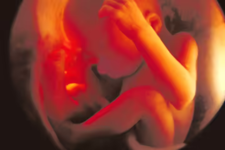 Month 7 Development (At 28 Weeks) Month 7 Development (At 28 Weeks)