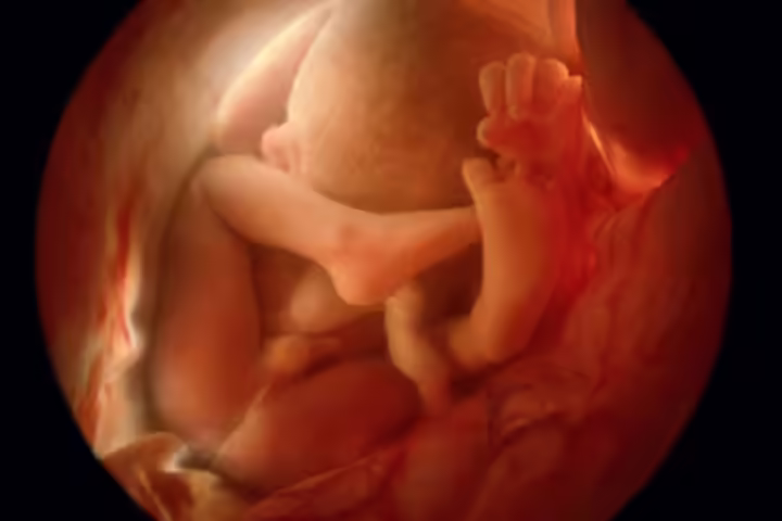 Month 9 Development (At 36 Weeks) Month 9 Development (At 36 Weeks)