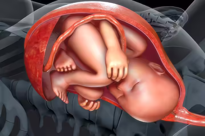 Placenta Abruption Placenta Abruption