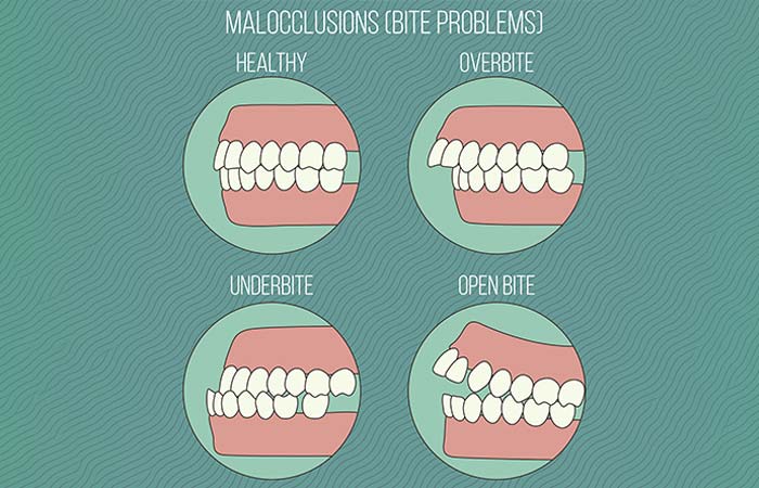 Dental Issues