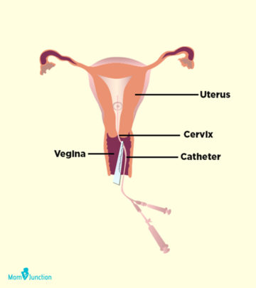 This process helps determine uterine abnormalities to obtain timely treatment.